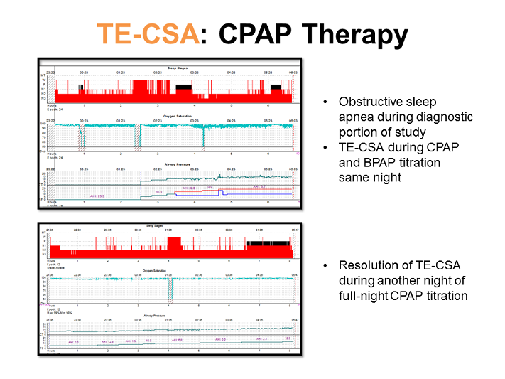 CPAP Therapy Opioid Induced Central Apnea And Treatment Emergent