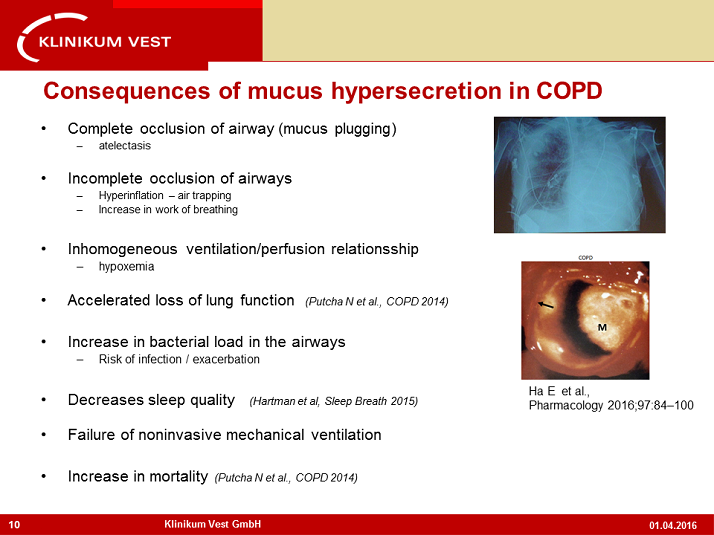 Consequences Of Mucus Hypersecretion In Copd Airway Secretion And Clearance In Copd Activity 