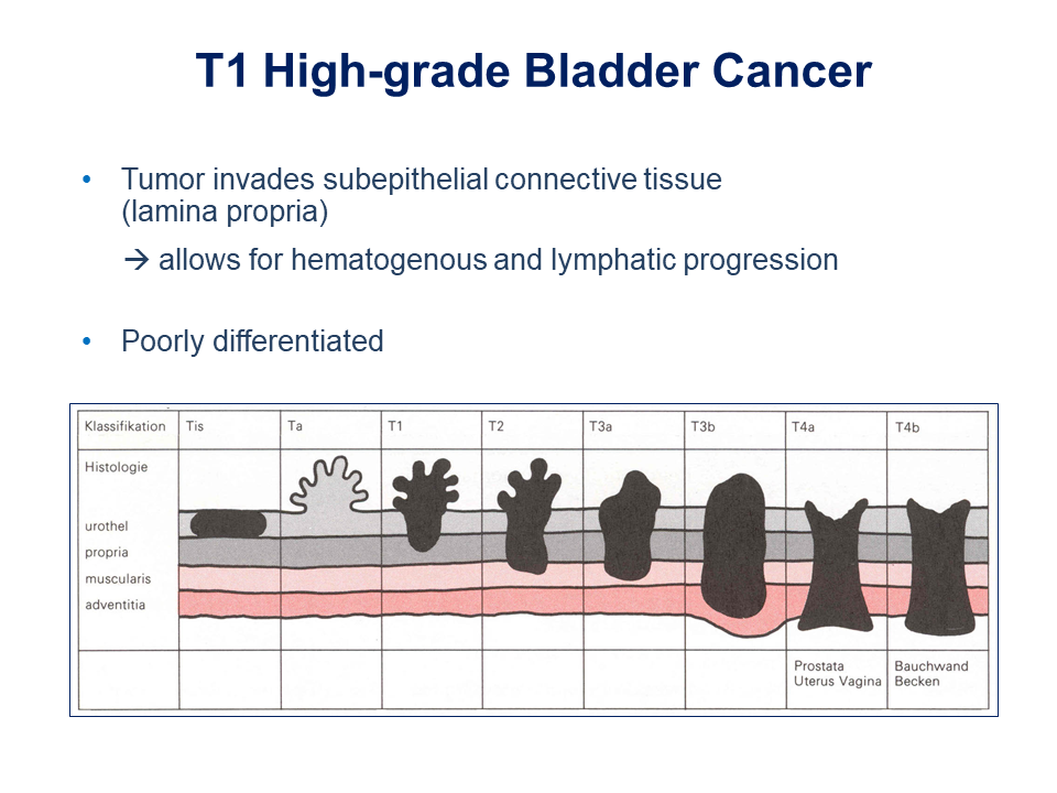 educational-centre-current-clinical-problems-in-bladder-cancer