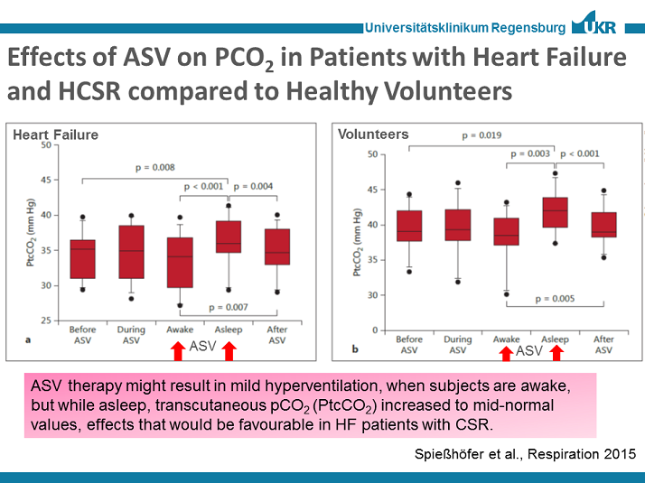 ASV Therapy might result in Mild Hyperventilation - Technology of Servo ...