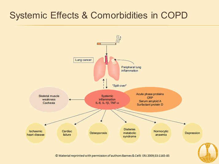 GOLD COPD 2017 Resource Center: Activity Seven