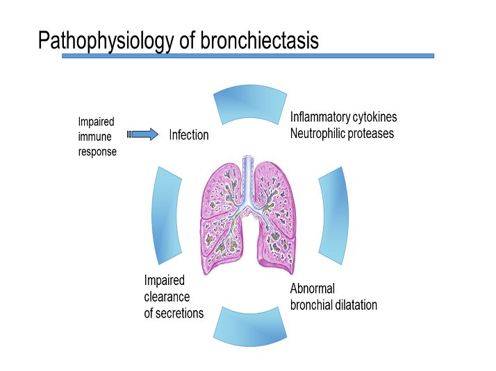 Pathophysiology Of Bronchiectasis - Bronchiectasis: Diagnosis And ...